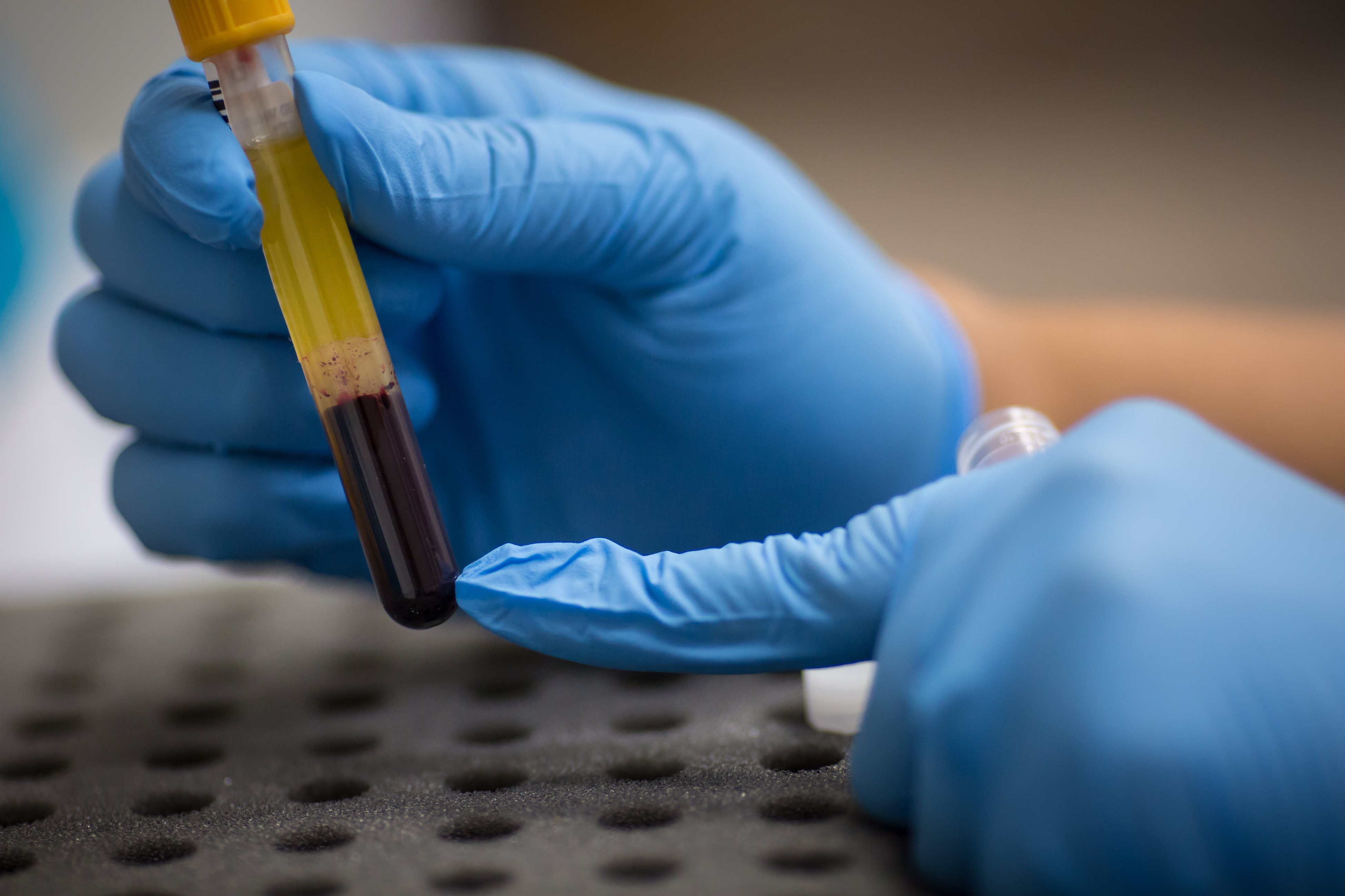 Gloved hands pointing at a blood sample in a vial.