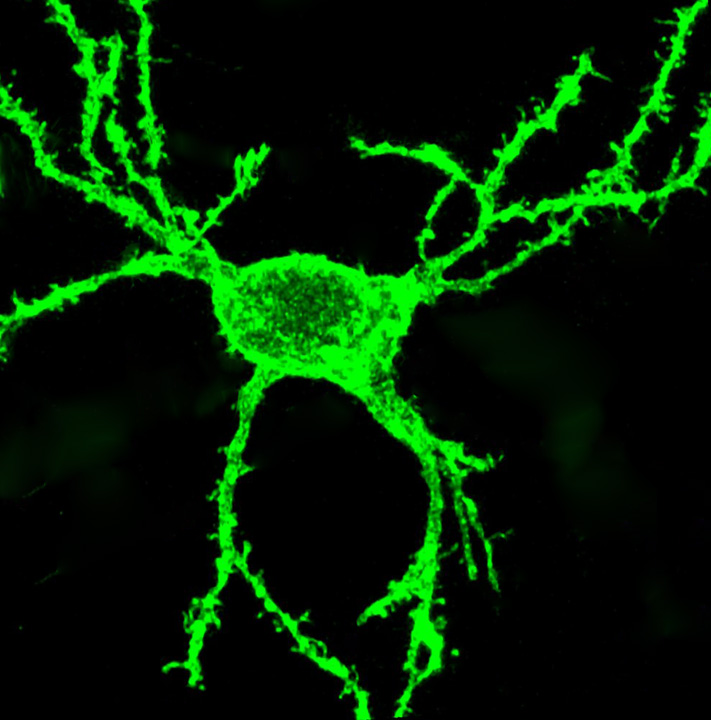 Neuronal Crab