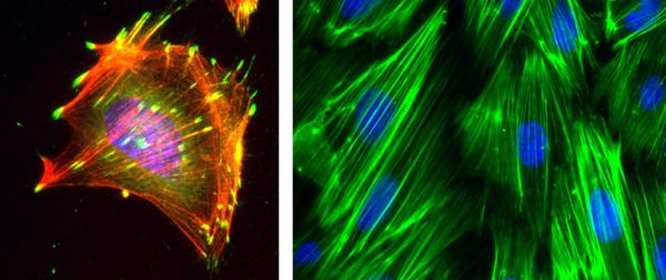 The image on the left shows a fibroblast cell stained for F-actin (red), zyxin (green) and DAPI (blue). Co-distribution of F-actin and zyxin is yellow. In the image on the right, fibroblasts were mechanically stimulated (uniaxial cyclic stretch) and stained for F-actin (green) and DNA (blue). The reinforced actin cytoskeleton aligns perpendicular to the horizontal stretch axis.