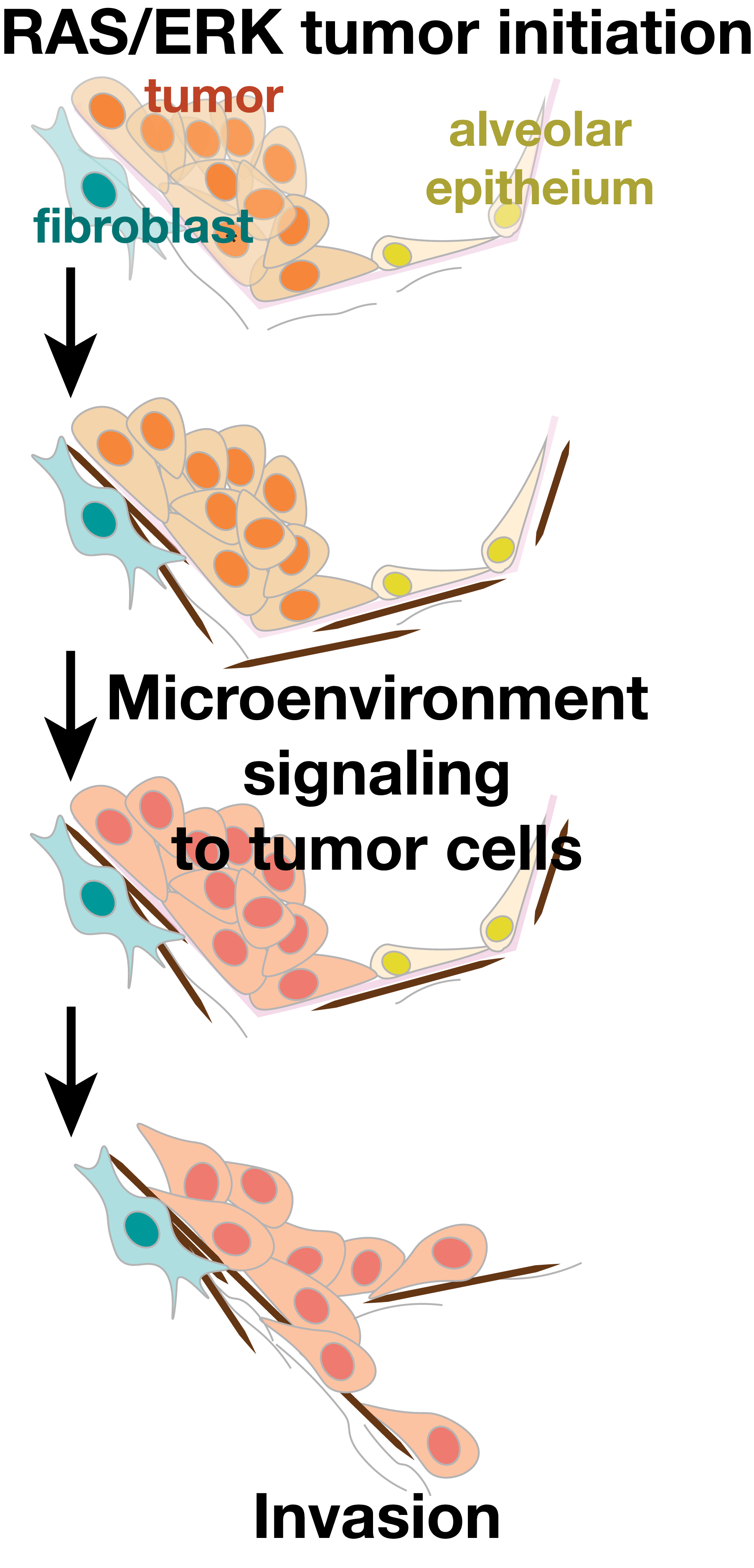 Diagram of early cancer invasion process