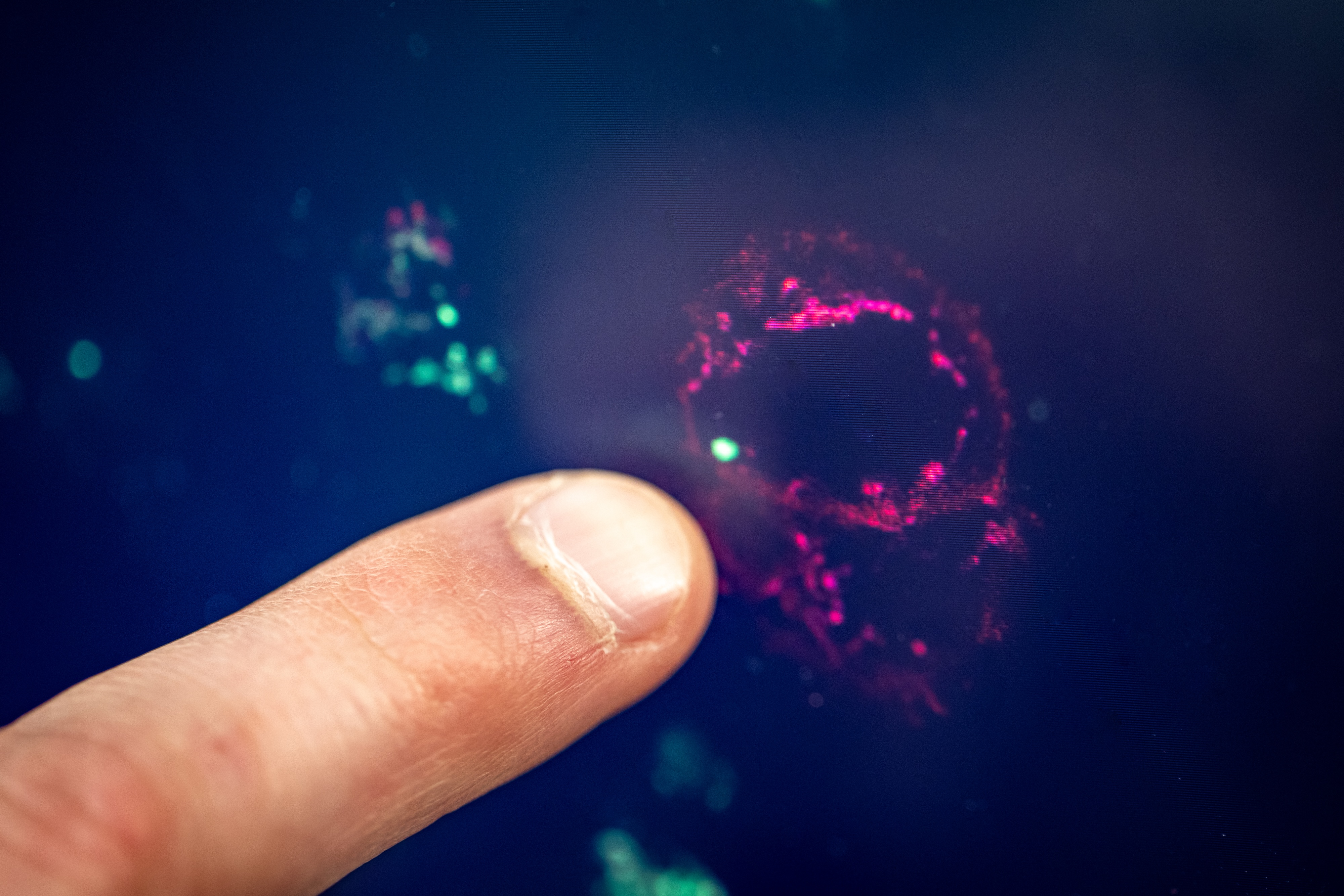 Close-up of a finger pointing at a fluorescent red-and-green microscope image.
