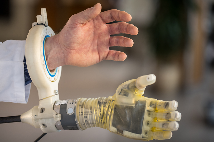real hand attached to robotic hand