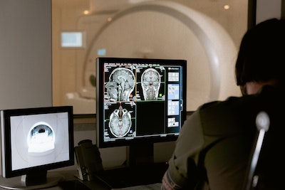 MRI brain images