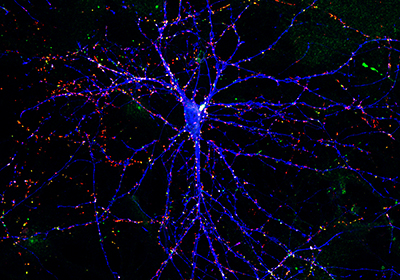 hippocampus neuron with synapses