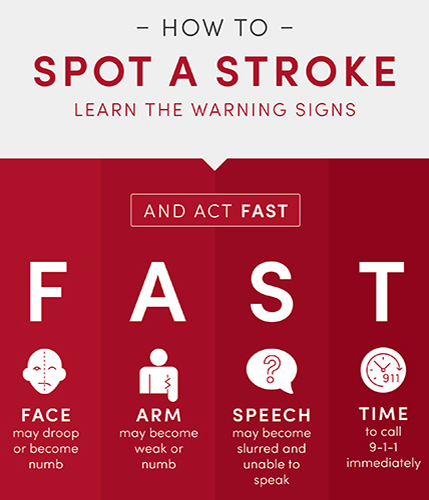 F – Facial weakness A – Arm weakness S – Speech problems T – Time to call.  