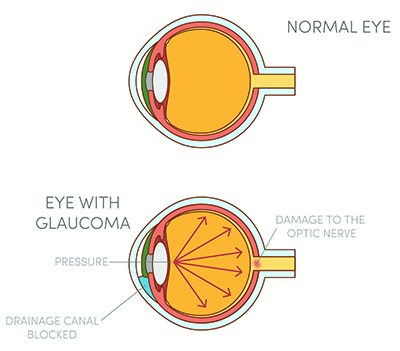 A diagram of an eye.