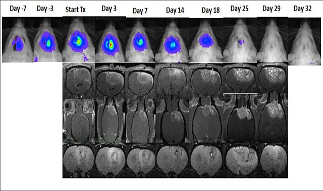 MRI showing pseudoprogression in mouse brain tumors