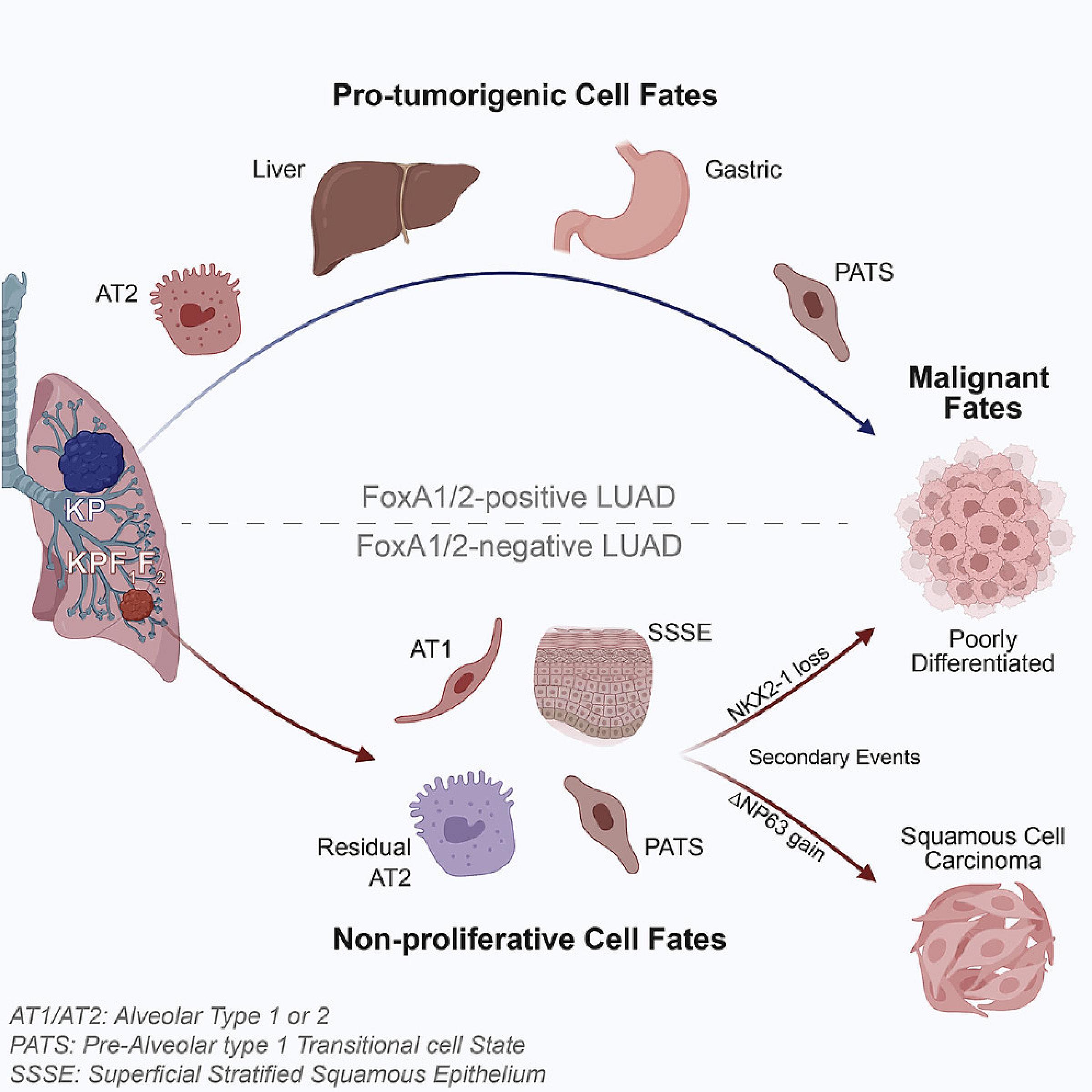 Diagram of cancer progression in cells