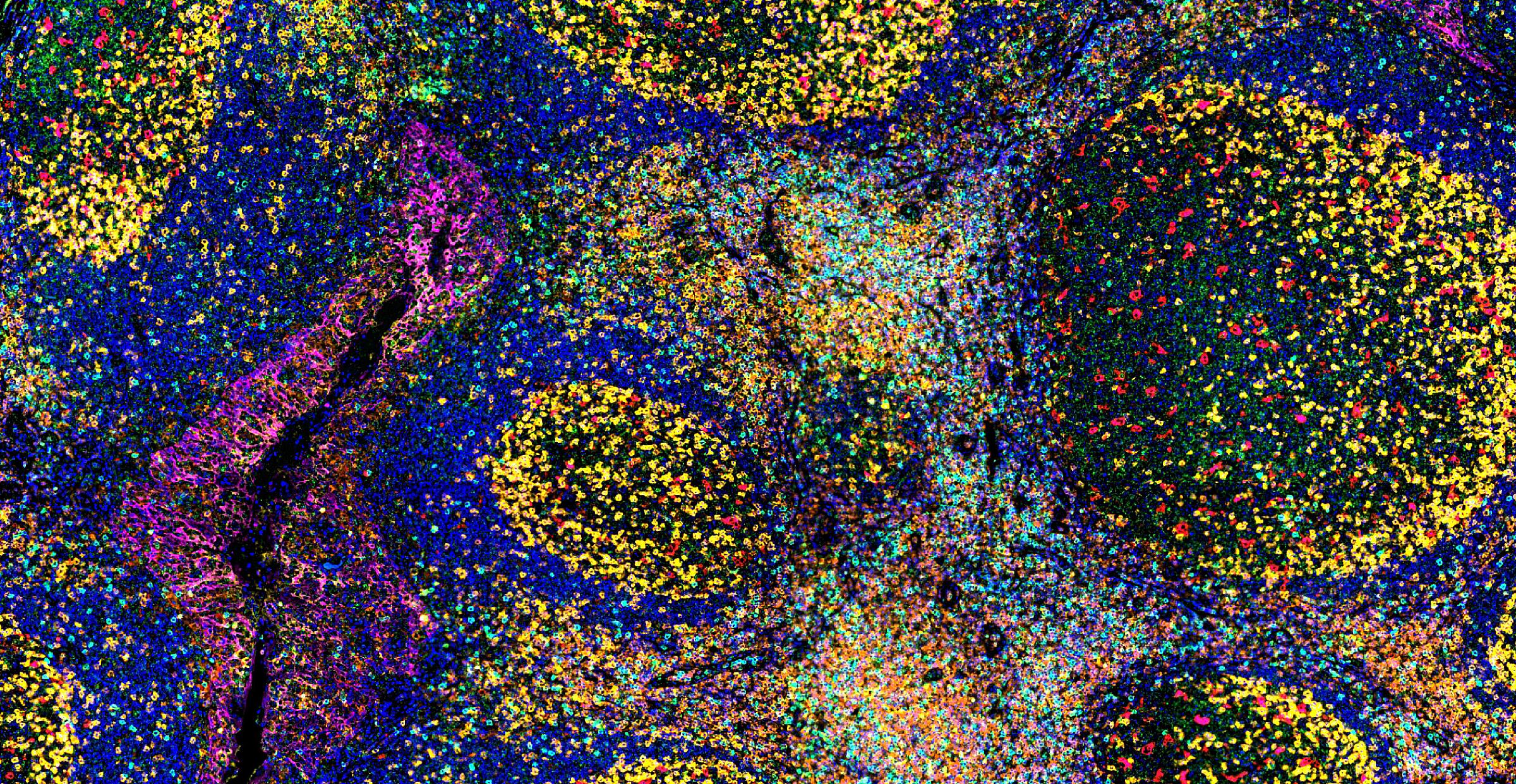 Human Tonsil Cells - composite image