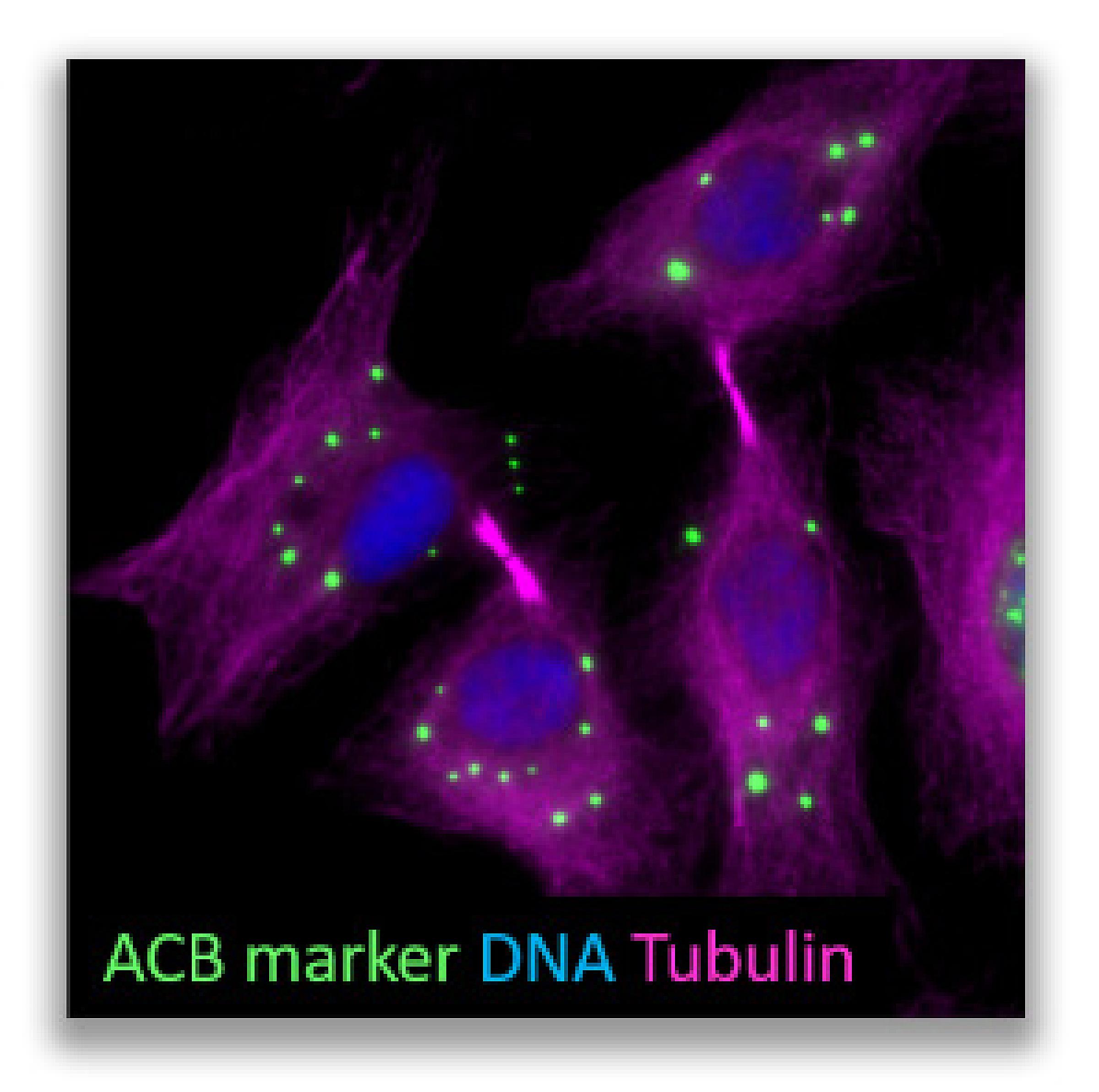 Formation of Abscission Checkpoint Bodies (ACB)