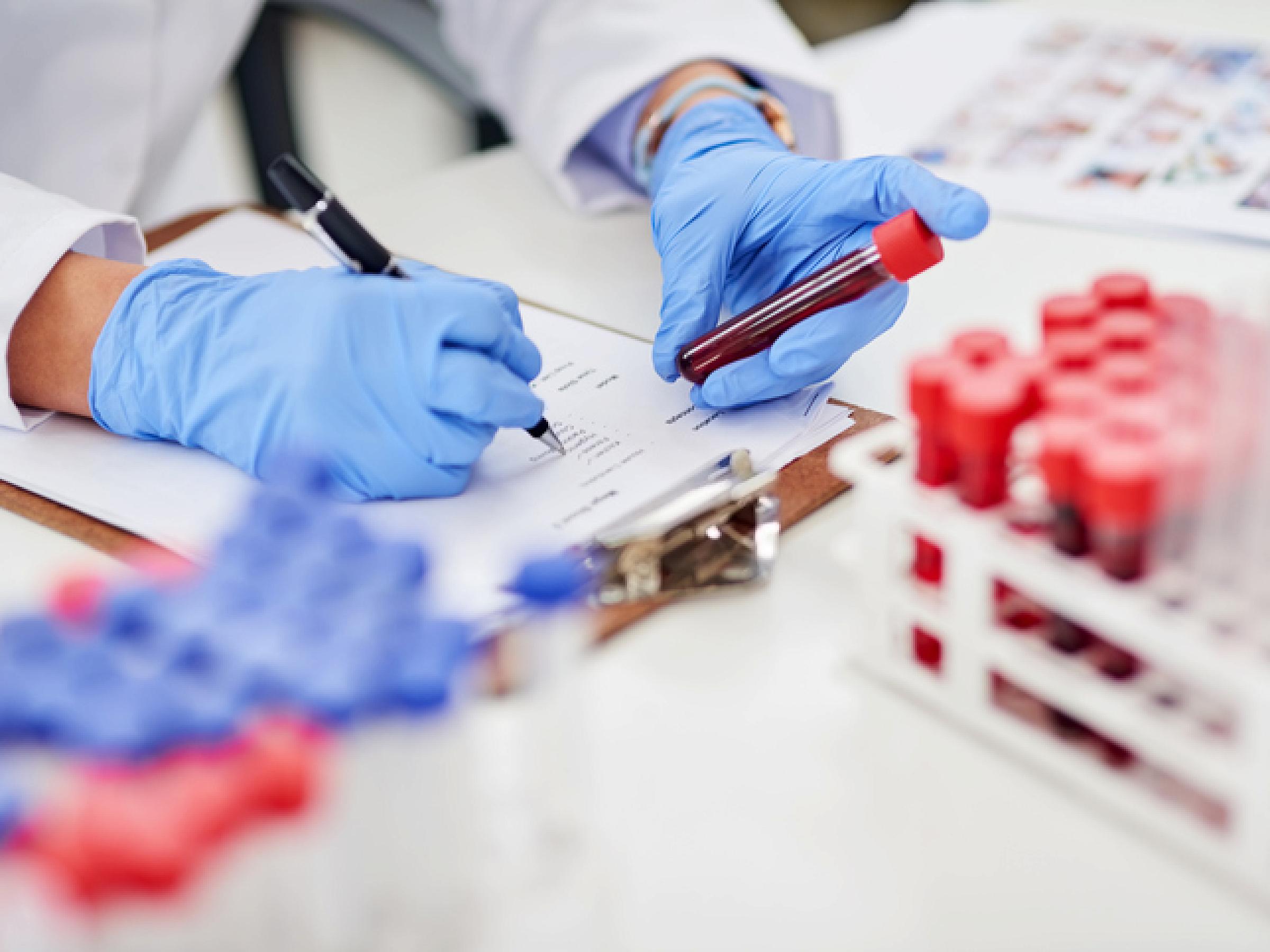 Gloved hands holding blood vial and writing on clipboarde
