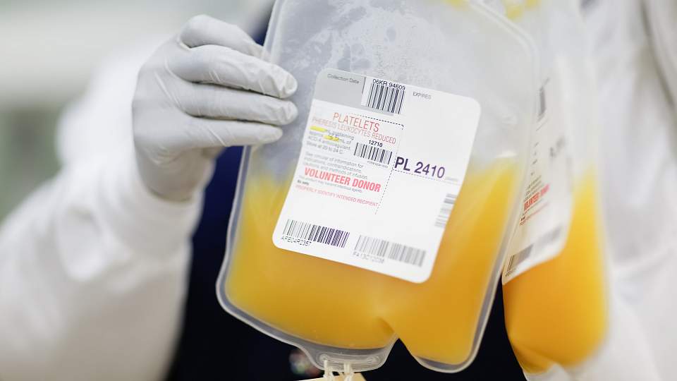 A blood bag half-full of yellow platelet-rich plasma.