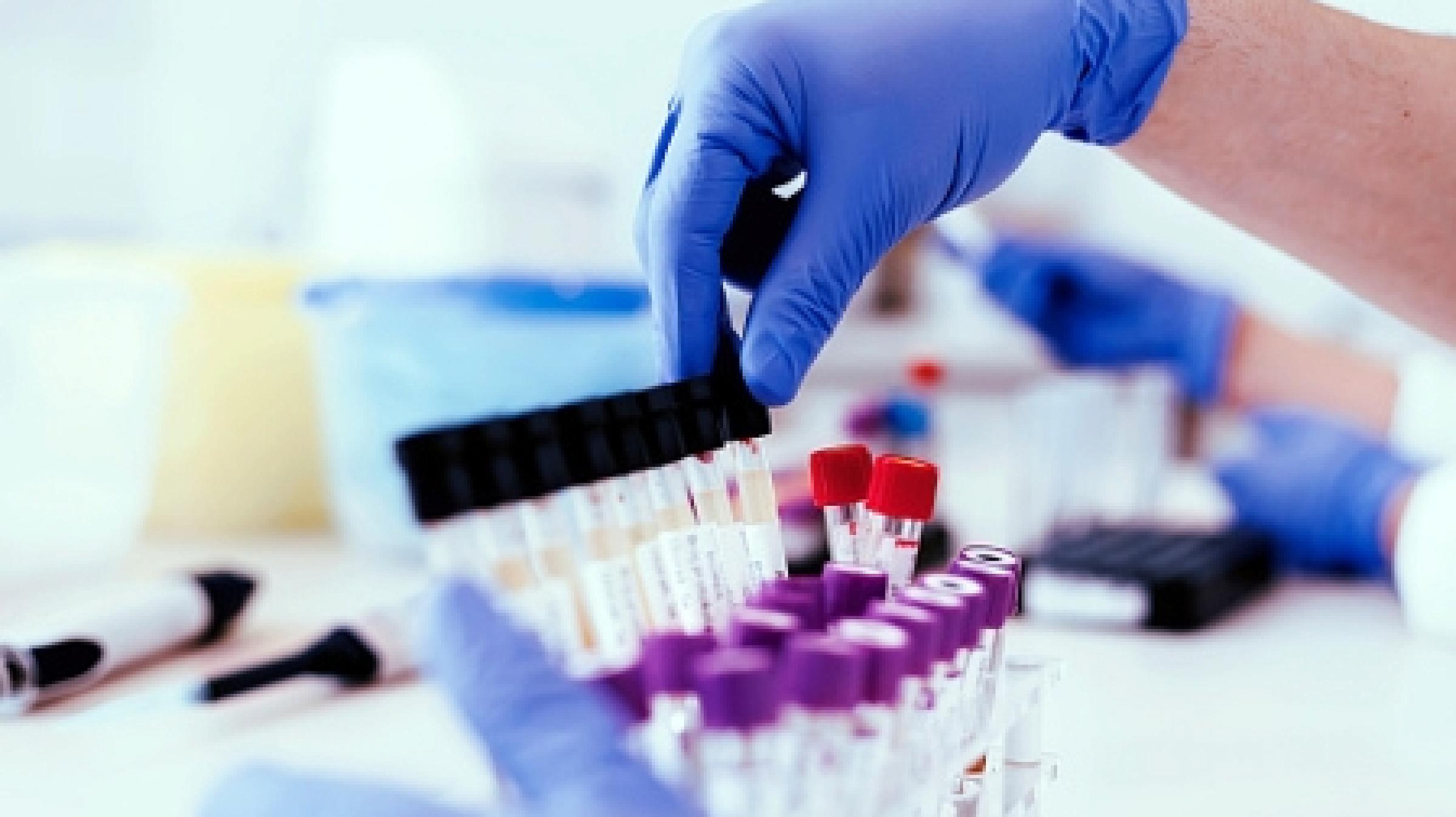 Gloved Hands with Test Tubes in Lab