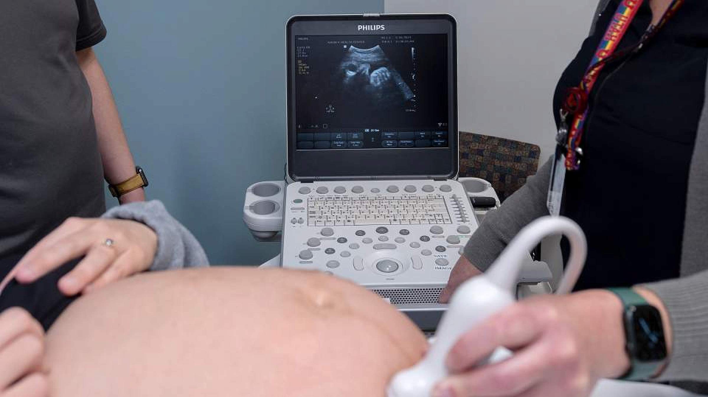 Madsen Health Center midwives use ultrasound technology