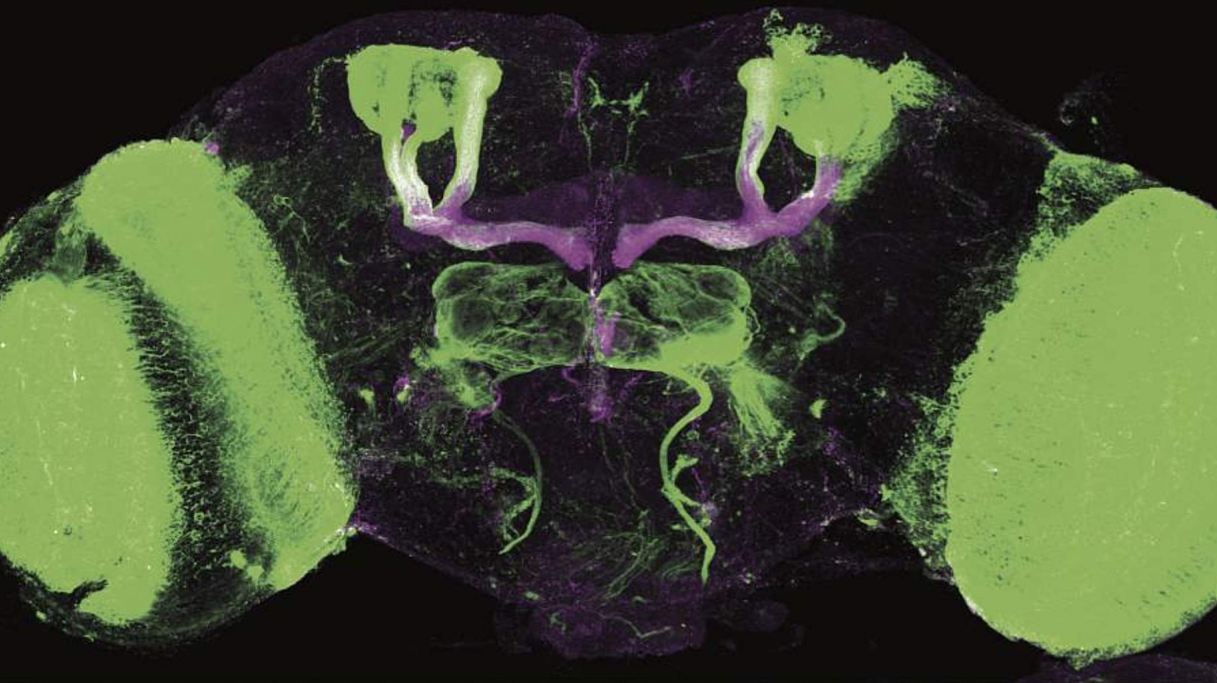 Alcohol use disorder can lead to persistent and serious insomnia. But research into fruit flies is yielding new insights. 